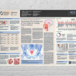 Case Study Research Poster Template for InDesign